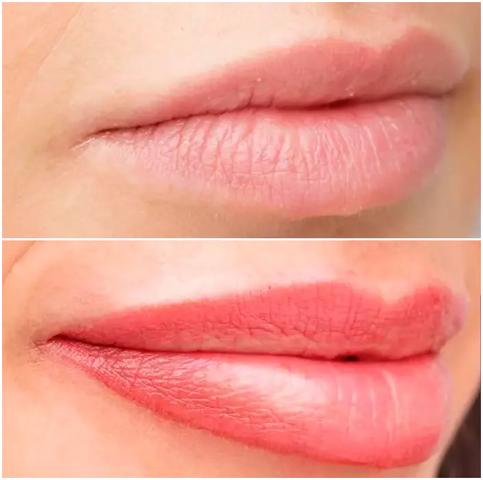 Lip micropigmentation comparison.